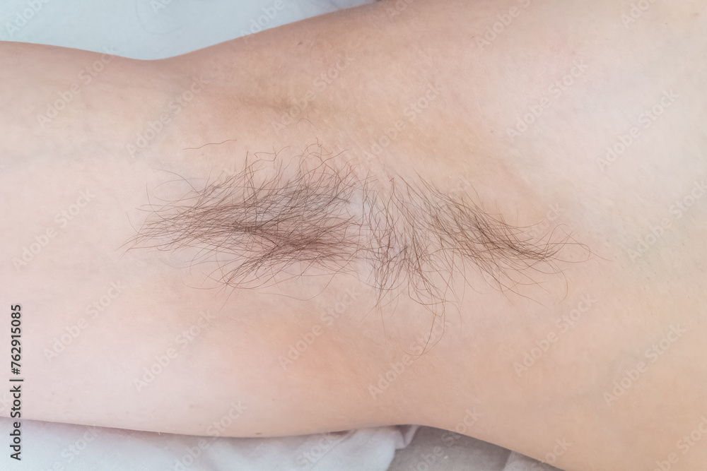 Closeup of long dark hair growing under arm of young female. Concept of hygiene, natural beauty, feminity and body hair growth Closeup of long dark hair growing under arm of young female. Concept of hygiene, natural beauty, feminity and body hair growth