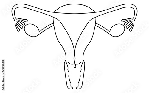Diagrammatic illustration of cervical polyps, anatomy of the uterus and ovaries