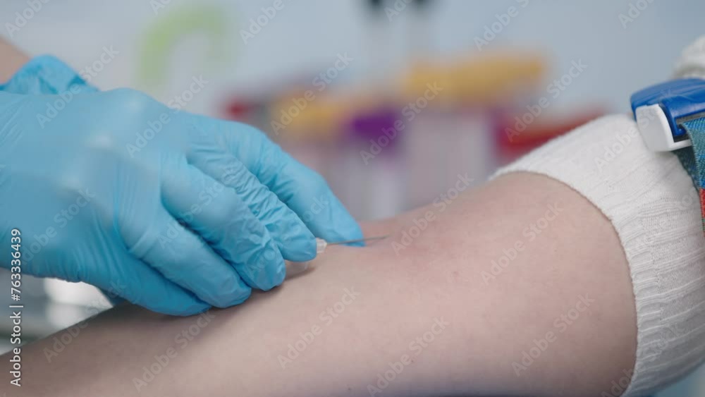 A female doctor takes a plasma sample from a patient to treat patients. Clinical studies, donation of blood, medications, tests. Covid-19 pandemic and medicine concept. A female doctor takes a plasma sample from a patient to treat patients. Clinical studies, donation of blood, medications, tests. Covid-19 pandemic and medicine concept.