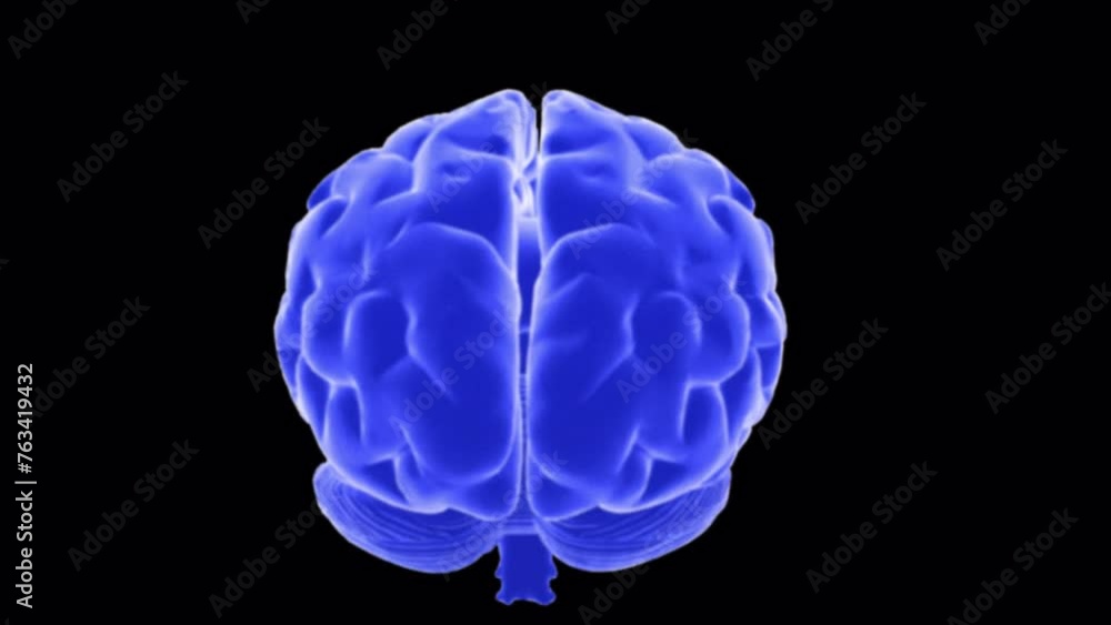 X-ray of Brain - 360 degree rotation X-ray of Brain - 360 degree rotation