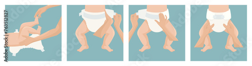 Flat Vector Illustration of a Baby Diaper. Side and Top View. Infant Underwear, Stages of Changing Diaper Panties. Ultimate Guide, Step by Step Diapering Tutorial. Tips for Diapering