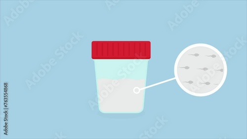 semen sperm test sample. Reproductive health check