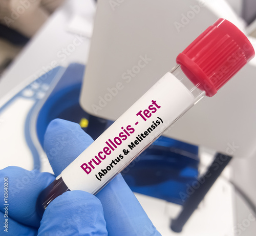 Blood sample for Triple antigen test, diagnosis of salmonellosis, brucellosis and rickettsia diseases. Febrile antigen test. photo