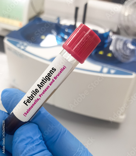 Blood sample for Triple antigen test, diagnosis of salmonellosis, brucellosis and rickettsia diseases. Febrile antigen test. photo