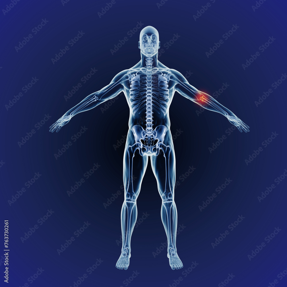 Body, skeleton and red pain in arm with graphic for xray, exam or analysis in medical overlay. 3D anatomy, radiology and elbow for illustration of injury or physiotherapy on a dark or blue background