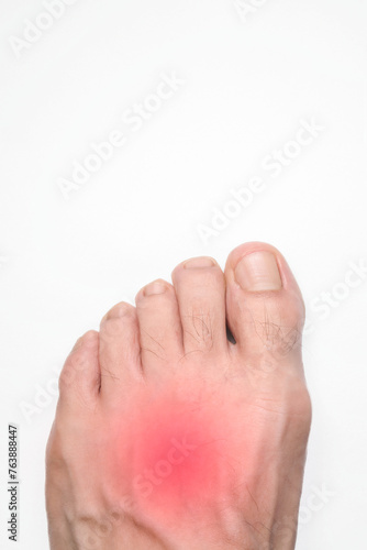 Obraz na plátně Instep of a person left foot with a red mark representing pain, with space above