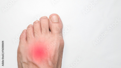 Instep of a person left foot with a red mark representing pain, with space on the right for text