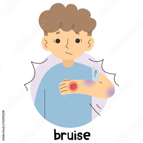 Bruise 3 cute on a white background, vector illustration.
