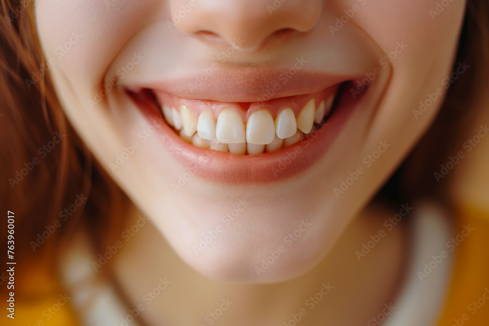 Obraz premium Beautiful cute smile with very clean perfect teeth. Chin, nose and mouth visible. Dental service advertisement