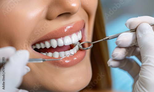 Female patient having her teeth examined by dentist. Close up. Dental clinic promotion. Teeth whitening, dental treatment, oral hygiene, treat a tooth. Smiling young woman receiving dental checkup