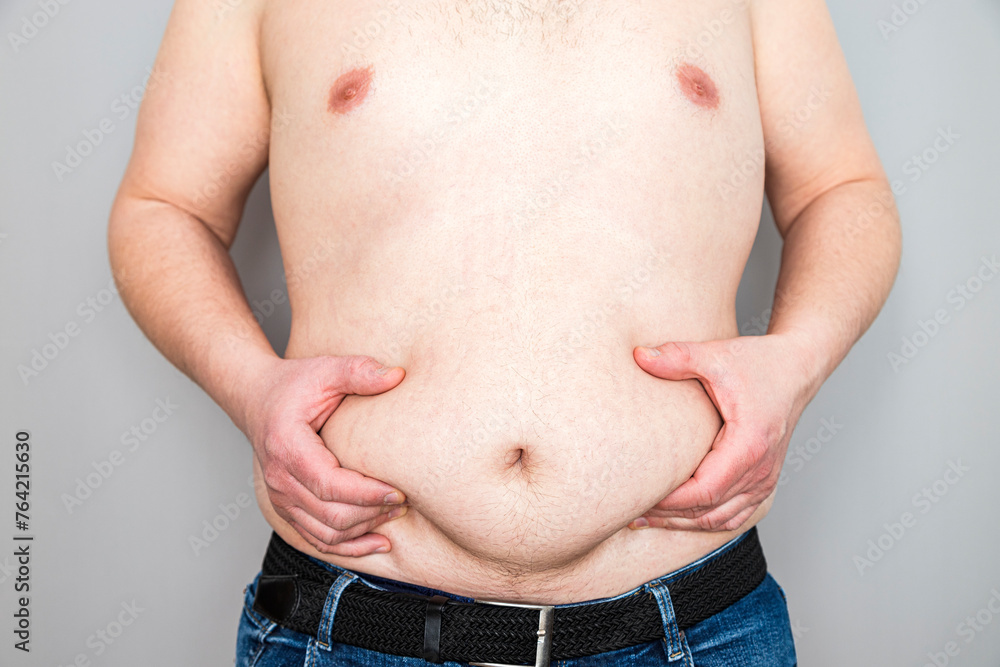 Naklejka premium Overweight Man Gripping Stomach Fat, Health Issue