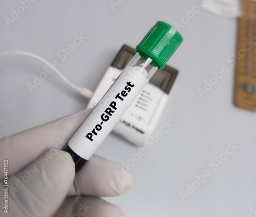 Blood sample for proGRP (Pro-Gastrin-releasing peptide) test, marker for small cell lung cancer. photo