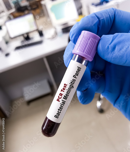 Blood sample for Meningitis Bacterial panel test by PCR. Diagnosis of brain infection medical concept, meningitis, encephalitis. photo