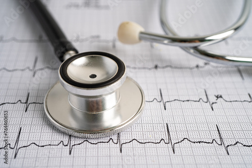 Stethoscope on electrocardiogram ECG, heart wave, heart attack, cardiogram report.
