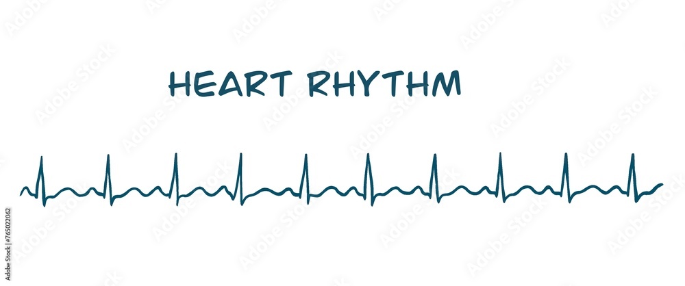 ECG image show normal sinüs rhythm