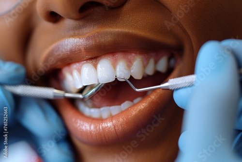 Smiling woman receives dental examination and cleaning