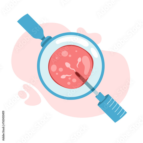 intra cytoplasmic Insemination of Sperm. artificial insemination