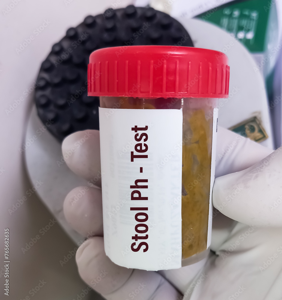 Container with feces for Stool pH test, It tested for acidity in order