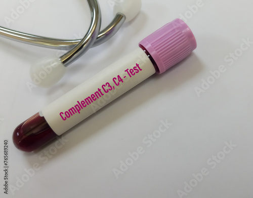 Blood Sample for C3, C4 (Complement) test with laboratory background. Closeup. Diagnosis of autoimmune disorders. photo