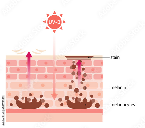 紫外線が肌に与える影響_Effects of ultraviolet rays on the skin