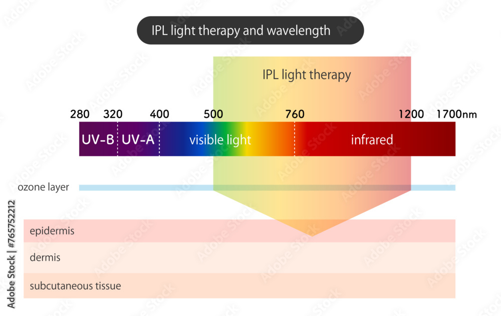 Fototapeta premium IPL光治療と波長_IPL light therapy and wavelength
