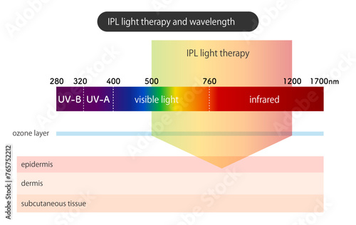 IPL光治療と波長_IPL light therapy and wavelength