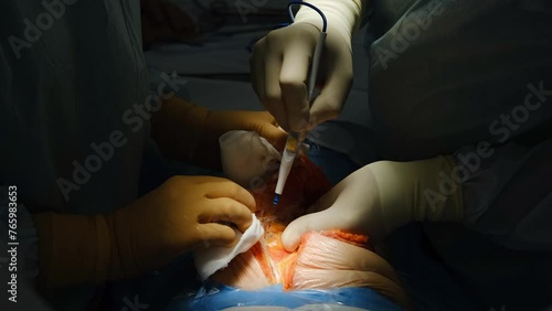 The doctor makes an incision with a scalpel on the abdomen. Plastic surgery operation. 