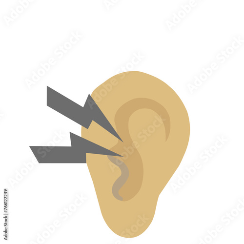 Otitis Ear 
