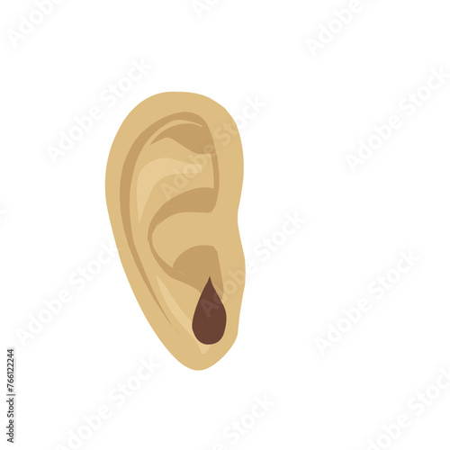 Otitis Ear 