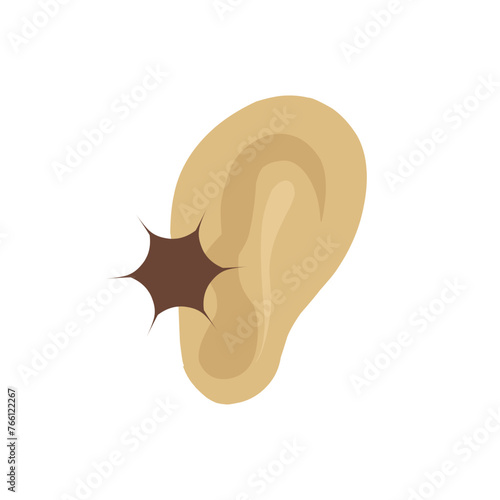 Otitis Ear 