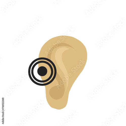 Otitis Ear 