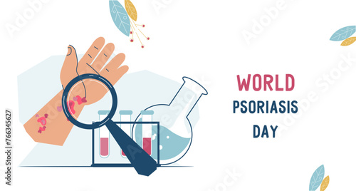 World Psoriasis Day custom banner template. Support for awareness and education about psoriasis with customizable design of web banner or poster, flat vector illustration on white backdrop.