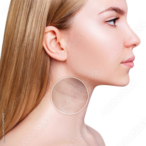 Zoom circle shows wrinkles on the neck.