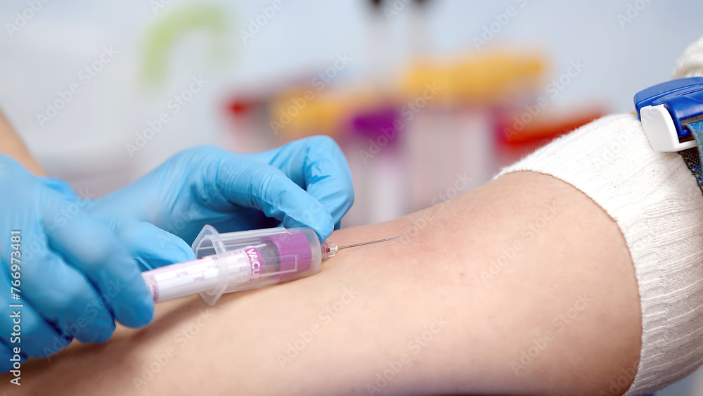 Obraz premium Blood donation close-up. Clinical studies, drugs, tests. Covid-19 pandemic and medicine concept.