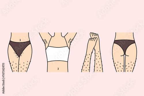 Hairy female legs and thighs in need of depilation or epilation using wax tape and sugaring. Body parts of girl in underwear, for advertising depilation services from cosmetologist