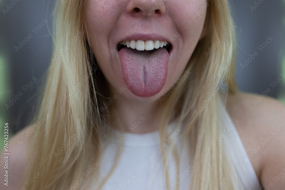 Girl Modeling Teeth and Mouth Facial Features and Expression, Pointing to Mouth, Blonde Young Girl Girl Modeling Teeth and Mouth Facial Features and Expression, Pointing to Mouth, Blonde Young Girl