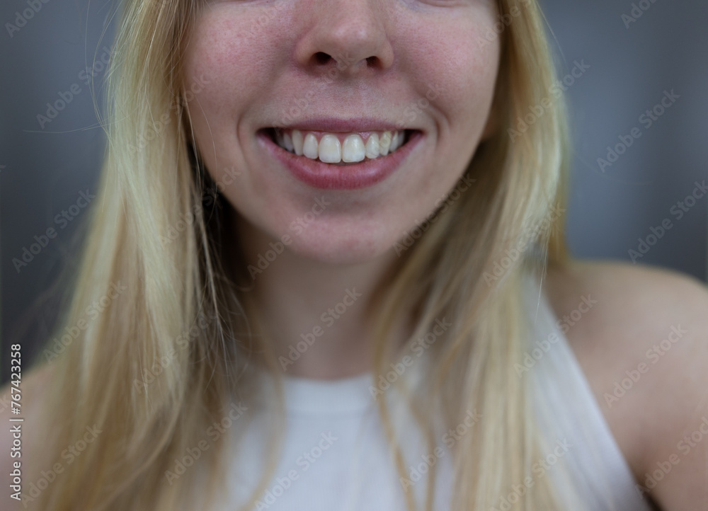 Girl Modeling Teeth and Mouth Facial Features and Expression, Pointing to Mouth, Blonde Young Girl Girl Modeling Teeth and Mouth Facial Features and Expression, Pointing to Mouth, Blonde Young Girl