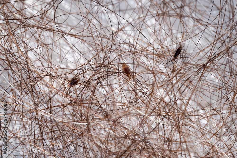 Close-up of head lice and nits on brown human hair, Anoplura, Medical conditions, Personal hygiene, Children's health, Parasites Close-up of head lice and nits on brown human hair, Anoplura, Medical conditions, Personal hygiene, Children's health, Parasites