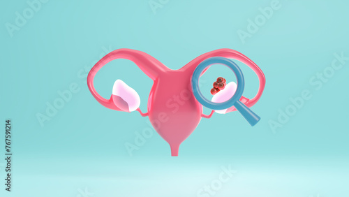 World Day of Ovarian Cancer, May 8, uterus reproductive system, Ovarian cancer illness in women's health, Gynecological, Uterine cancer, Vulvar cancer, Panic disorder.Copy space.3d render illustration