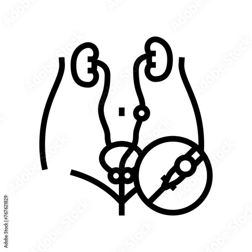 ureteroscopy urology line icon vector. ureteroscopy urology sign. isolated contour symbol black illustration