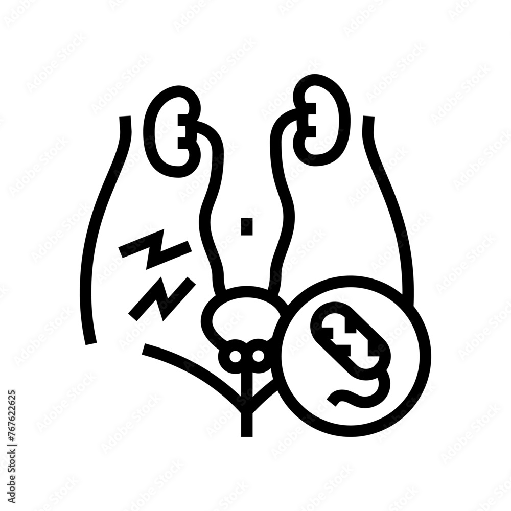 urethritis urology line icon vector. urethritis urology sign. isolated contour symbol black illustration urethritis urology line icon vector. urethritis urology sign. isolated contour symbol black illustration