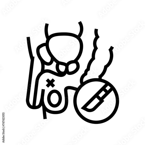 vasectomy urology line icon vector. vasectomy urology sign. isolated contour symbol black illustration