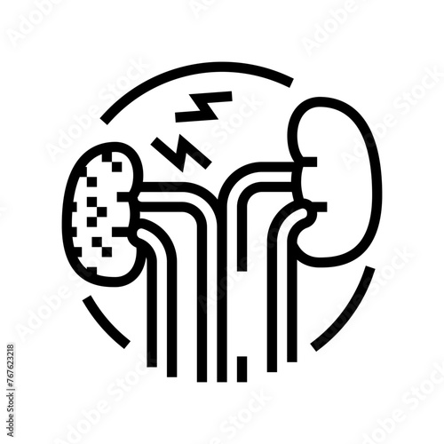 renal failure urology line icon vector. renal failure urology sign. isolated contour symbol black illustration