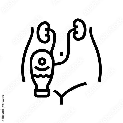 urostomy urology line icon vector. urostomy urology sign. isolated contour symbol black illustration