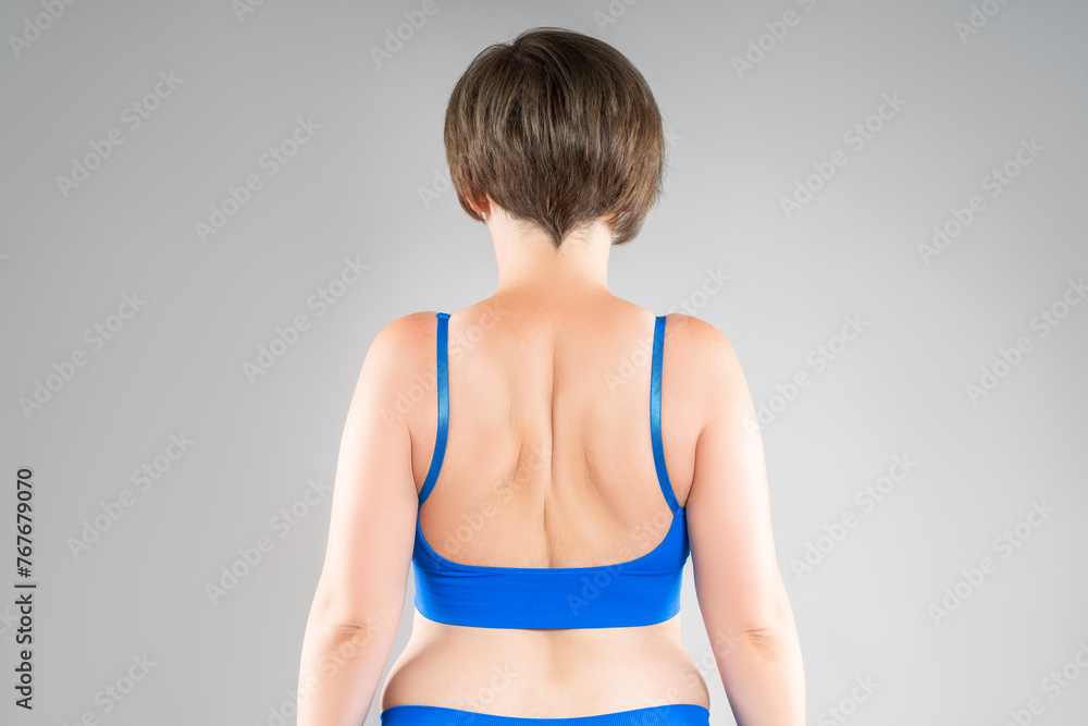 Φωτογραφία Female back, woman in blue bra on gray background, body care and correction of s