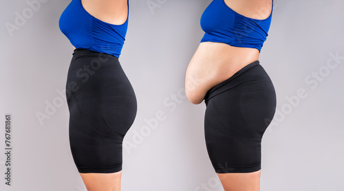 Woman's body before and after weight loss, flabby belly after pregnancy, fat woman in corrective panties on grey background, plastic surgery concept