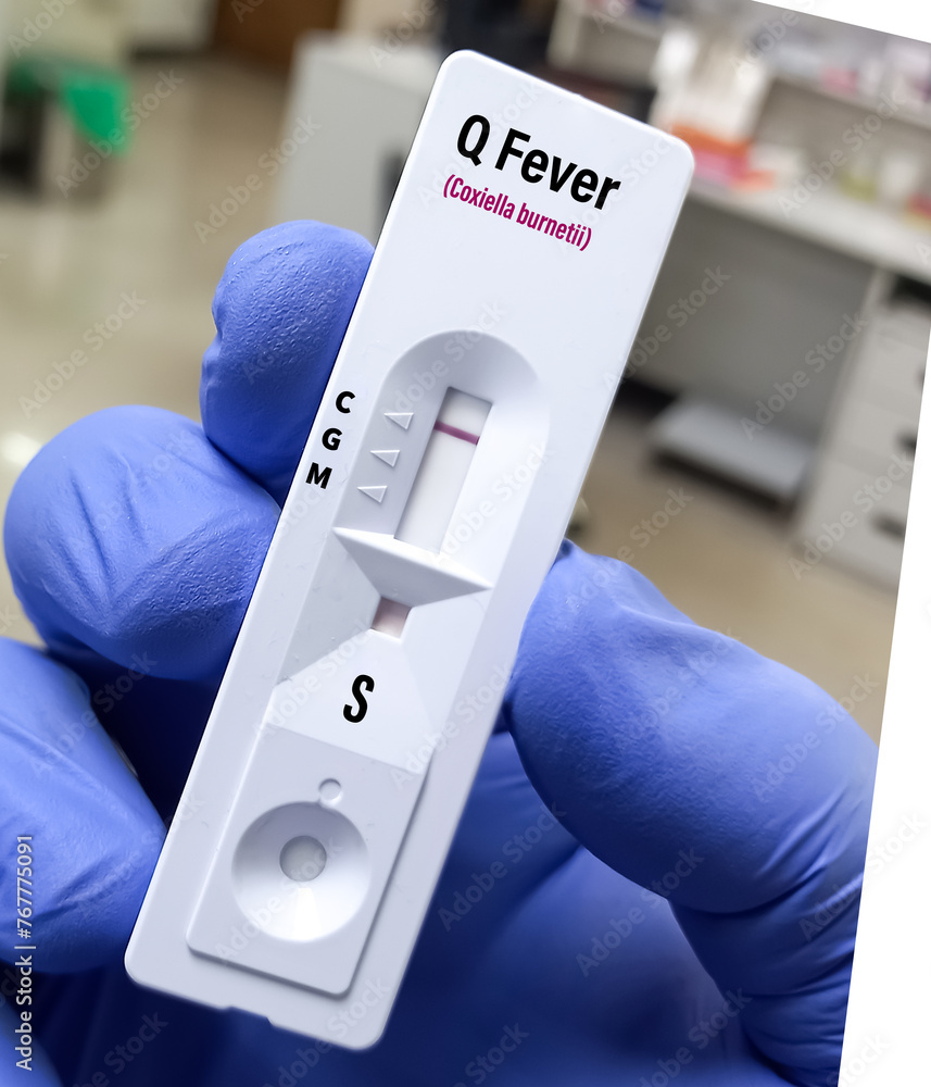 Blood sample for Q fever or query fever is a disease caused by infection with Coxiella burnetii. Coxiellosis. Blood sample for Q fever or query fever is a disease caused by infection with Coxiella burnetii. Coxiellosis.