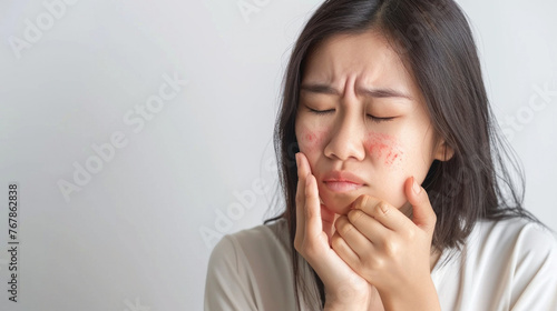 Asian woman with allergic reaction on hand, healthcare treatment on white background.