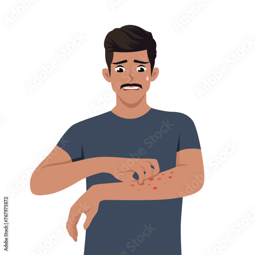 Young man scratching hand and arm. Man suffering from strong allergy skin itchy symptom. Flat vector illustration isolated on white background