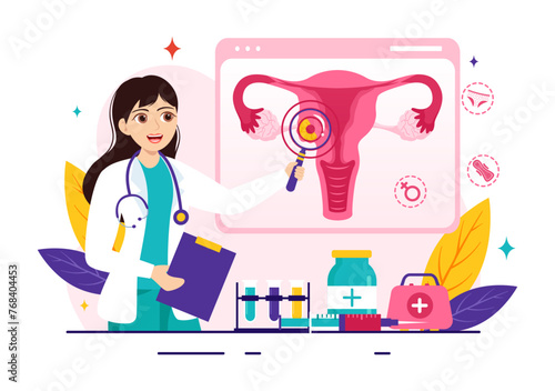 Endometriosis Vector Illustration with Condition the Endometrium Grows Outside the Uterine Wall in Women for Treatment in Flat Cartoon Background